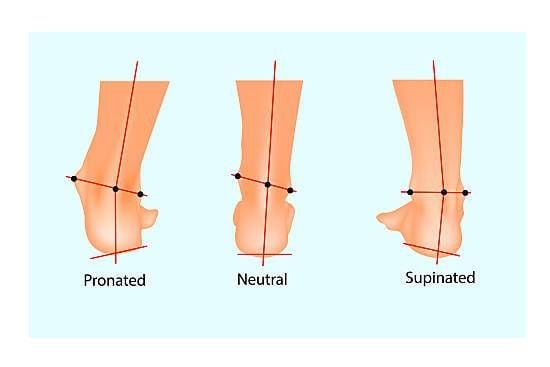 A Podiatrist's Guide to Foot Pronation vs. Supination - New York